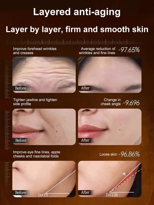 🔥BUY 1 GET 1 FREE🔥Polypeptide Collagen Elastic Essence Cream
