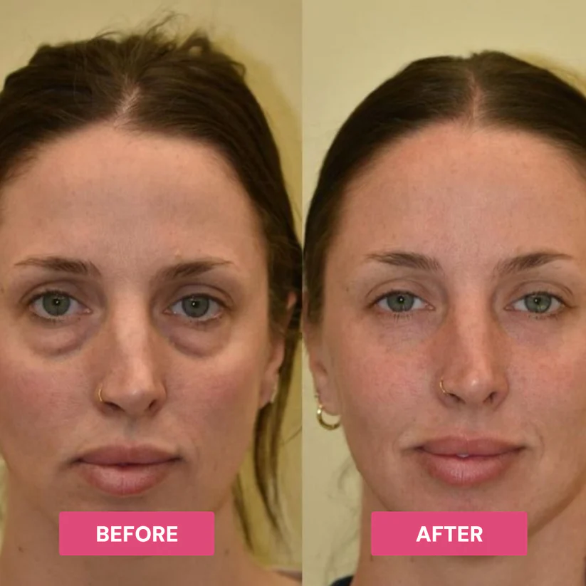 💓Revive Tired Eyes -Hydrating & Anti-Wrinkle Eye Balm💘
