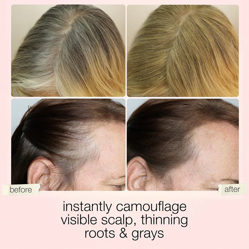 ⏰Last day for half-price discount🛒Hair Concealer – Instantly Covers Gray Roots & Thinning  Hair💖