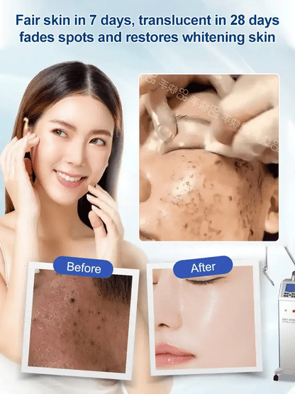 🔥Buy 1 Get 1 Free🔥Spot Fading Urea Cream
