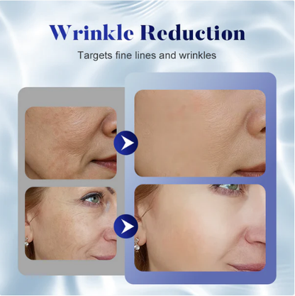 🔥Buy 1 Get 1 Free🔥Anti-Wrinkle Firming Face Cream