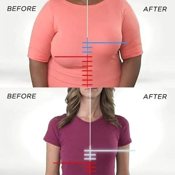 FRONT CLOSURE ACUTEFEBRUARY BRA(BUY 1 FREE 2)