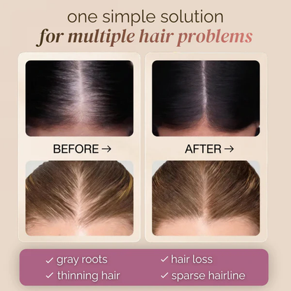 ⏰Last day for half-price discount🛒Hair Concealer – Instantly Covers Gray Roots & Thinning  Hair💖