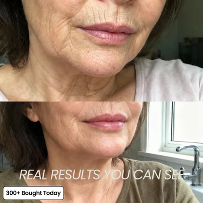 Zorevyn Korean Pink CollagenVolume Multi Balm✨