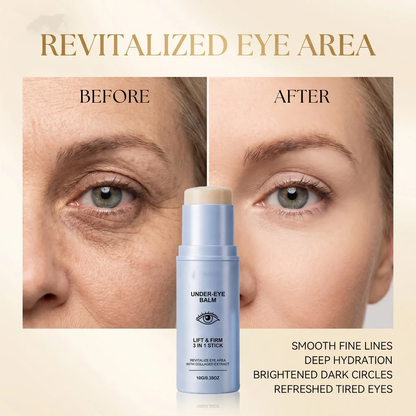 ✨ Korean Collagen Eye Miracle Stick  Wake Up Looking 10 Years Younger In Seconds 👀